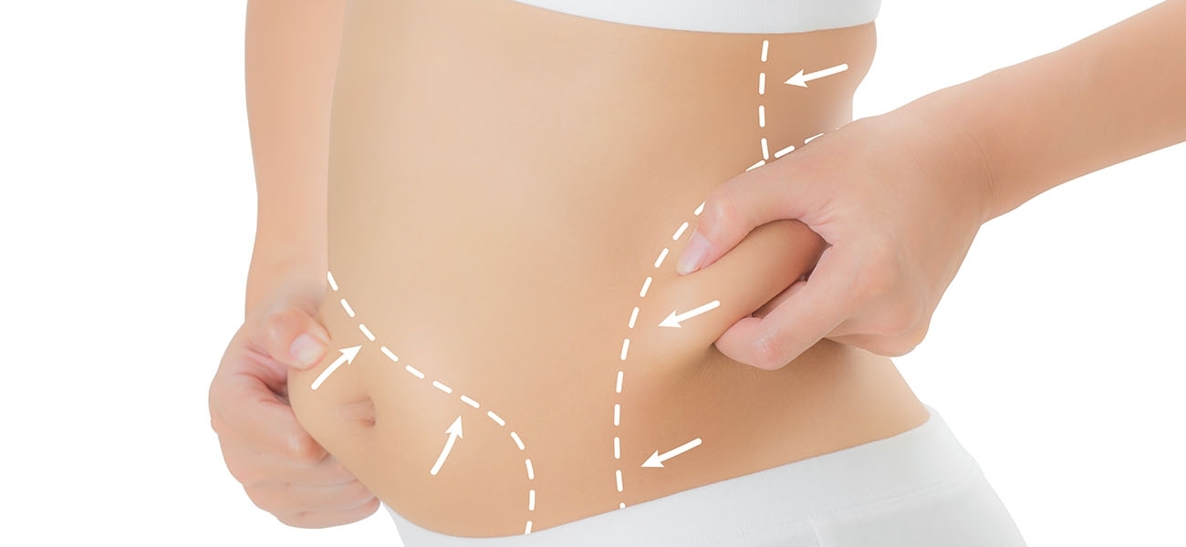 Liposuction in Turkey