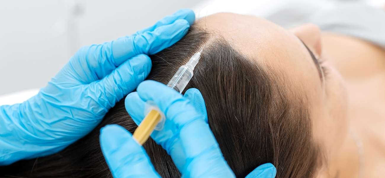 prp sac nedir nasil uygulanir faydalari nelerdir saglik rehberi denizli ozel cerrahi hastanesi